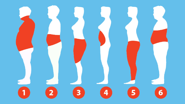 Types of Obesity Surgery